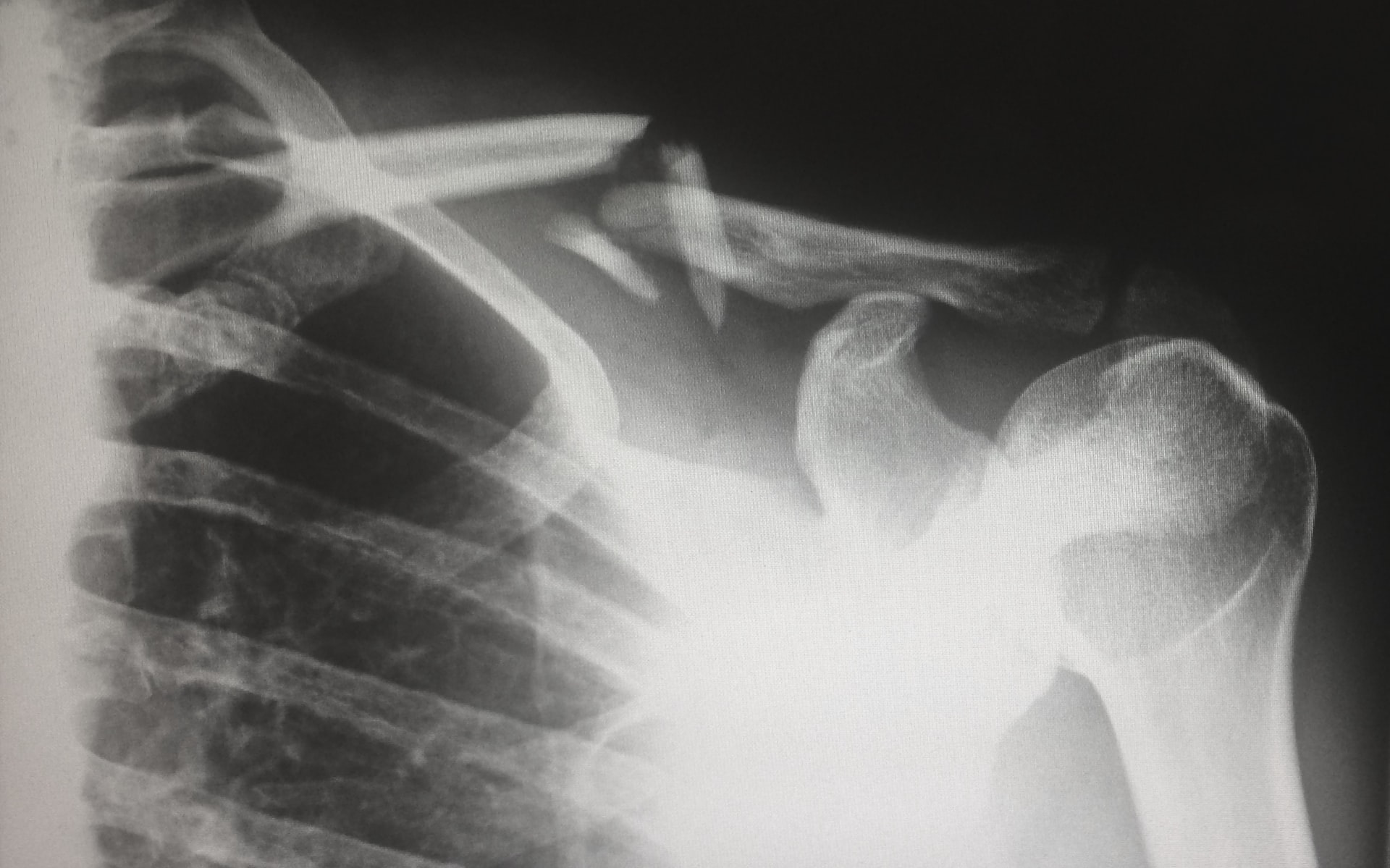 Motorcycle Accident Lawyer NJ